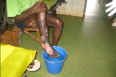 home-of-life-foundation-leg-ulcer-care-image4