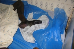 home-of-life-foundation-leg-ulcer-care-image7